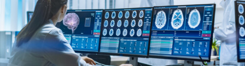 Team of Professional Scientists Work in the Brain Research Laboratory. Neurologists / Neuroscientists Surrounded by Monitors Showing CT, MRI Scans Having Discussions and Working on Personal Computers.