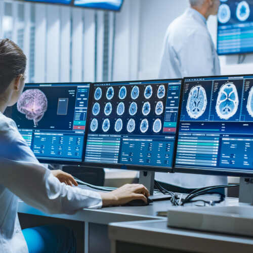 Team of Professional Scientists Work in the Brain Research Laboratory. Neurologists / Neuroscientists Surrounded by Monitors Showing CT, MRI Scans Having Discussions and Working on Personal Computers.