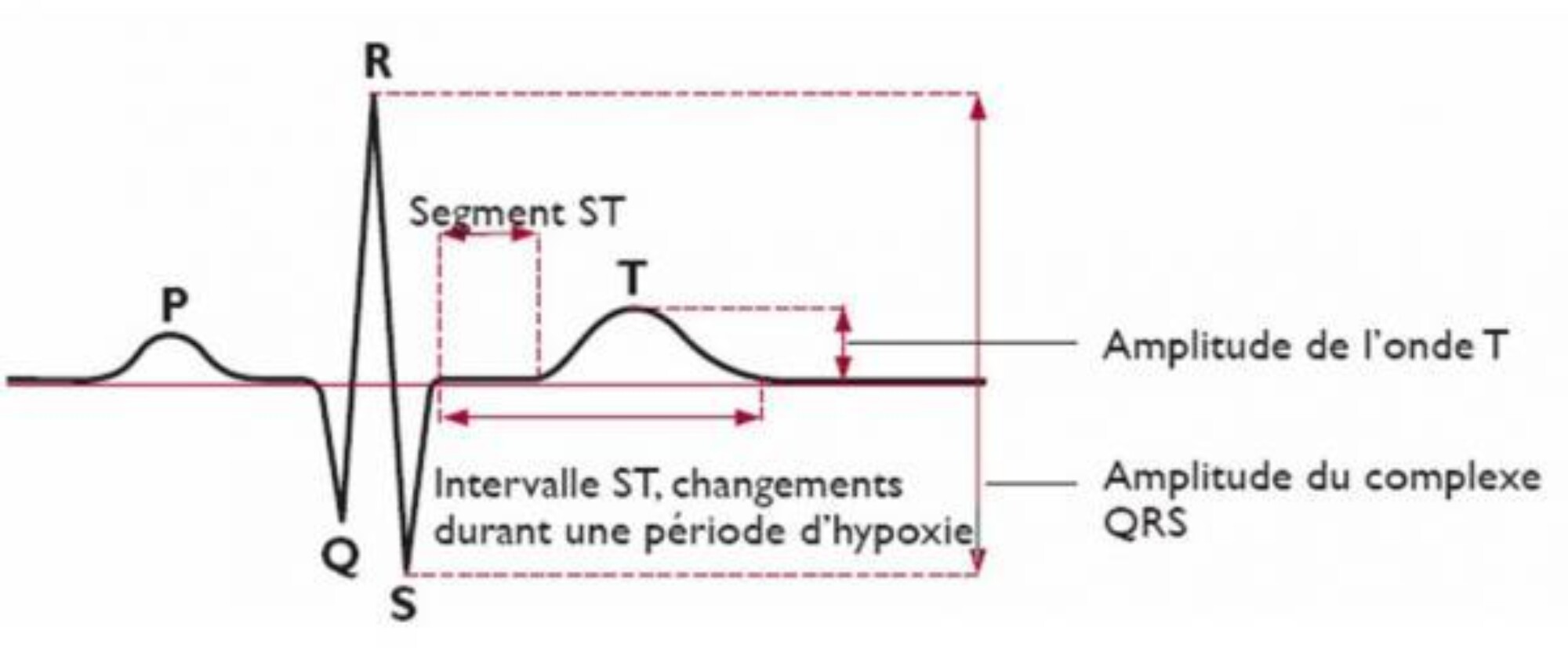 surveillance-foetale_reference