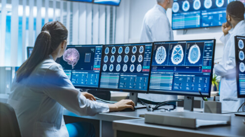 Team of Professional Scientists Work in the Brain Research Laboratory. Neurologists / Neuroscientists Surrounded by Monitors Showing CT, MRI Scans Having Discussions and Working on Personal Computers.