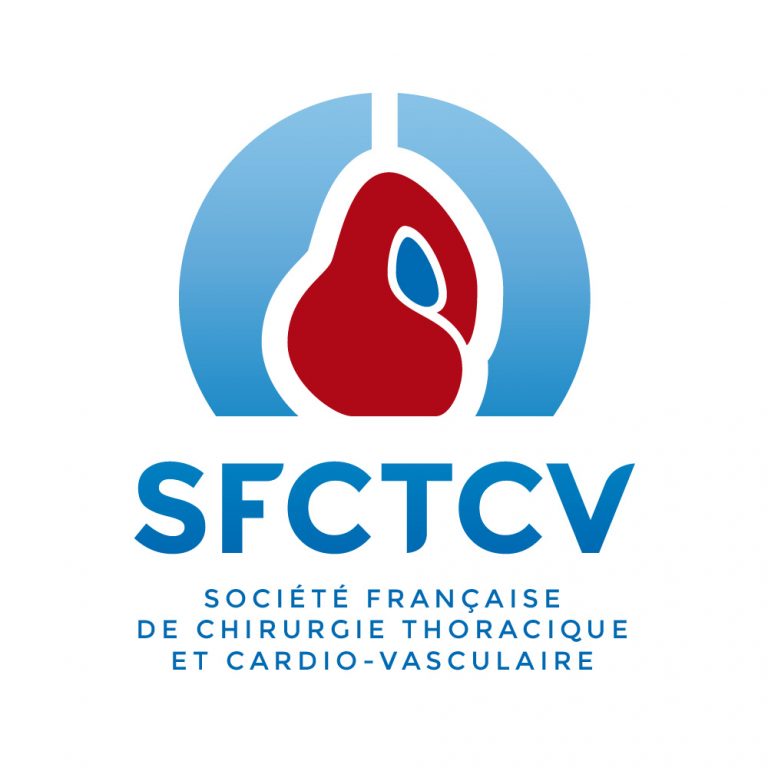 SFCTCV